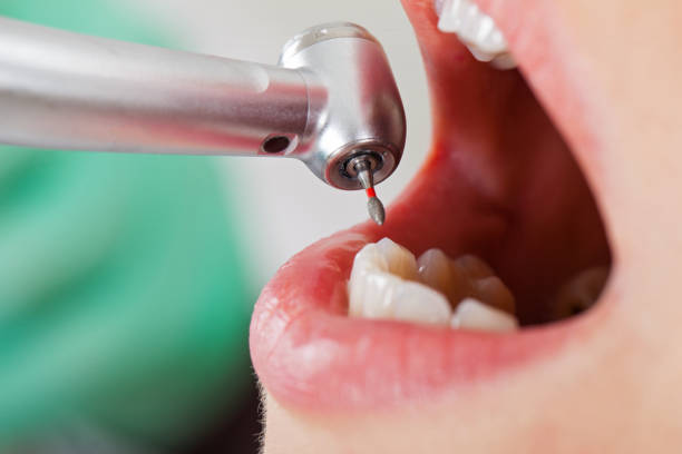 Best Knocked-Out Tooth Emergency  in Douglas, AZ